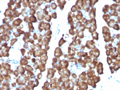 Formalin-fixed, paraffin embedded rat pancreas sections stained with 100 ul anti-Ornithine Decarboxylase-1 (clone ODC1/487) at 1:400. HIER epitope retrieval prior to staining was performed in 10mM Citrate, pH 6.0.